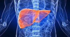 Hepatitis