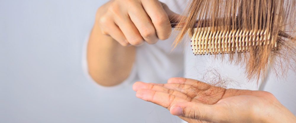 Caída del cabello: Causas y tratamientos